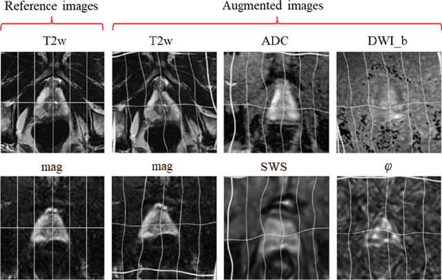 Figure 3 for Fully automated quantification of in vivo viscoelasticity of prostate zones using magnetic resonance elastography with Dense U-net segmentation