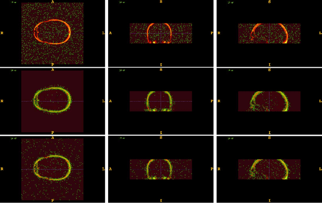Figure 1 for Optimization over Random and Gradient Probabilistic Pixel Sampling for Fast, Robust Multi-Resolution Image Registration