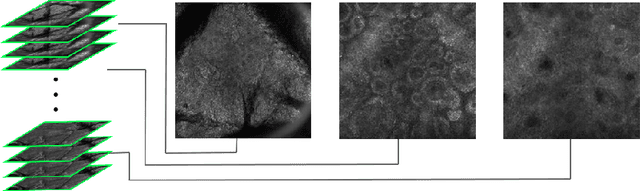 Figure 1 for Delineation of Skin Strata in Reflectance Confocal Microscopy Images using Recurrent Convolutional Networks with Toeplitz Attention