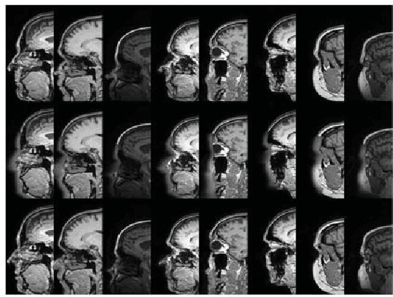 Figure 2 for Refacing: reconstructing anonymized facial features using GANs