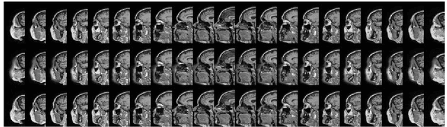 Figure 4 for Refacing: reconstructing anonymized facial features using GANs