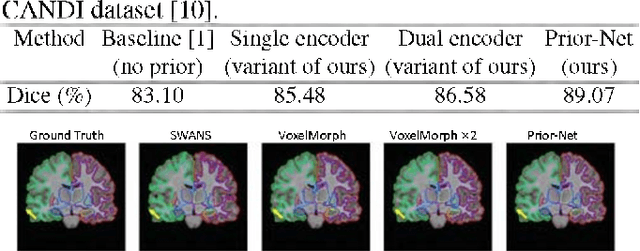 Figure 2 for Learning Shape Priors by Pairwise Comparison for Robust Semantic Segmentation