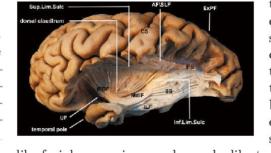 Figure 1 for Can you tell? SSNet -- a Sagittal Stratum-inspired Neural Network Framework for Sentiment Analysis