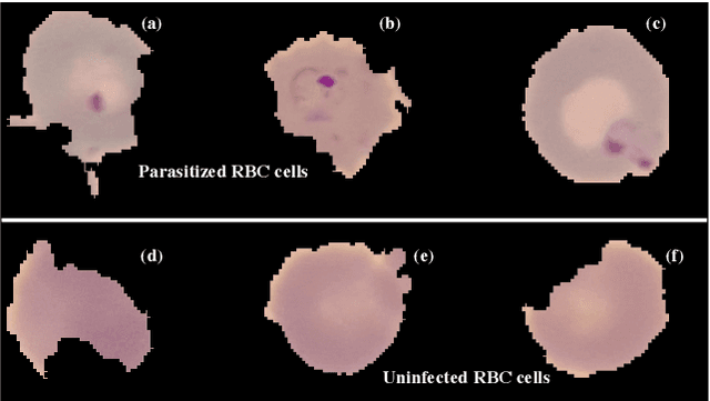 Figure 1 for Malaria detection from RBC images using shallow Convolutional Neural Networks