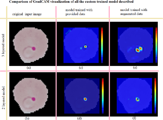 Figure 4 for Malaria detection from RBC images using shallow Convolutional Neural Networks