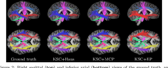 Figure 4 for White matter fiber analysis using kernel dictionary learning and sparsity priors