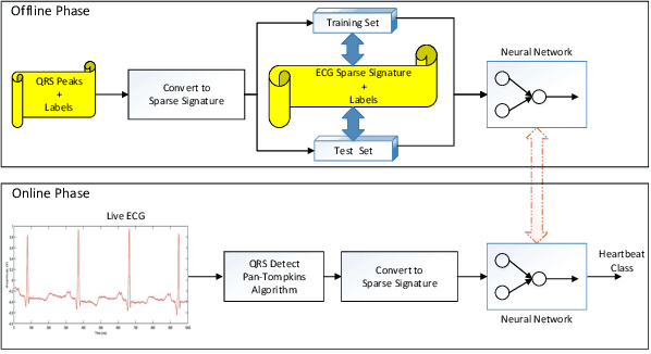 Figure 3 for Heartbeat Classification in Wearables Using Multi-layer Perceptron and Time-Frequency Joint Distribution of ECG