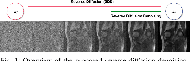 Figure 1 for MR Image Denoising and Super-Resolution Using Regularized Reverse Diffusion