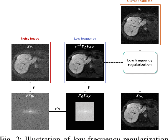 Figure 2 for MR Image Denoising and Super-Resolution Using Regularized Reverse Diffusion