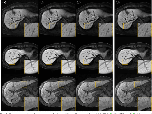 Figure 3 for MR Image Denoising and Super-Resolution Using Regularized Reverse Diffusion