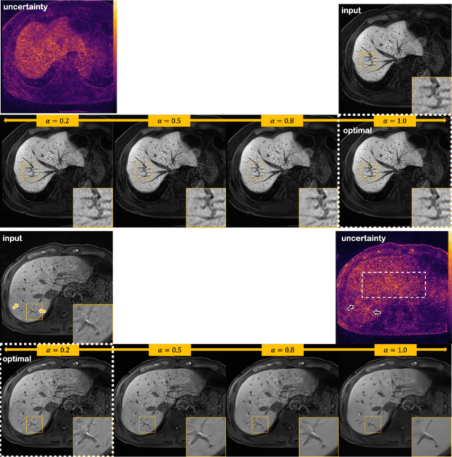 Figure 4 for MR Image Denoising and Super-Resolution Using Regularized Reverse Diffusion