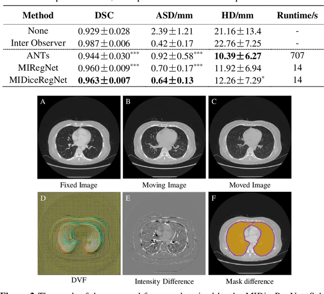 Figure 2 for Mutual information neural estimation in CNN-based end-to-end medical image registration