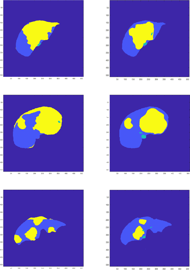 Figure 3 for A Time Series Graph Cut Image Segmentation Scheme for Liver Tumors