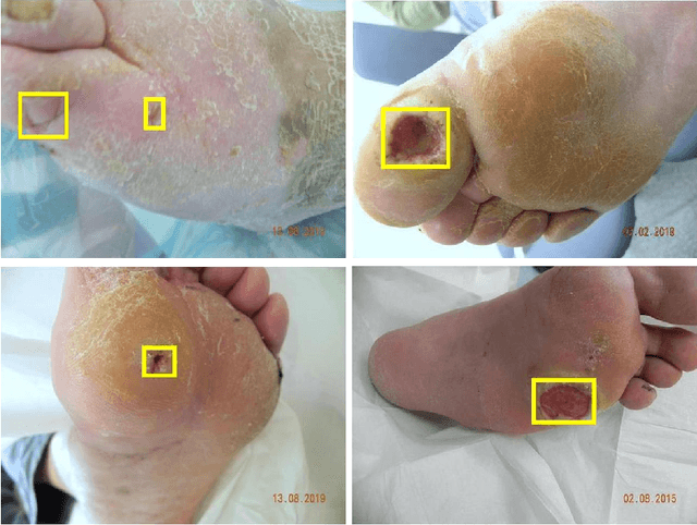 Figure 1 for A Refined Deep Learning Architecture for Diabetic Foot Ulcers Detection