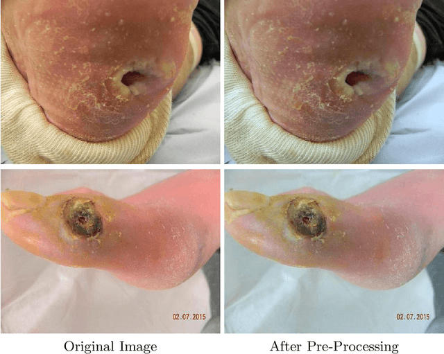 Figure 3 for A Refined Deep Learning Architecture for Diabetic Foot Ulcers Detection