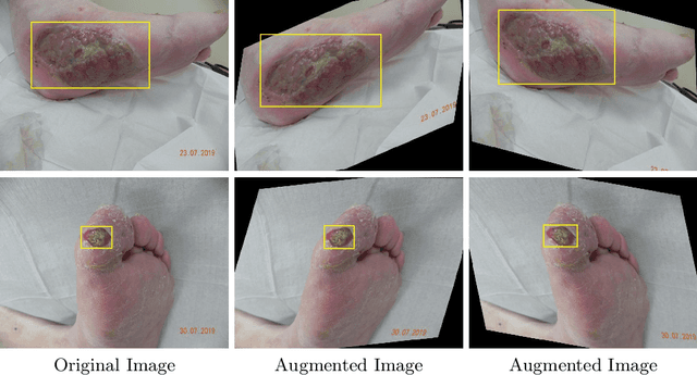 Figure 4 for A Refined Deep Learning Architecture for Diabetic Foot Ulcers Detection