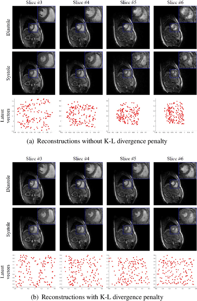 Figure 2 for Alignment & joint recovery of multi-slice dynamic MRI using deep generative manifold model