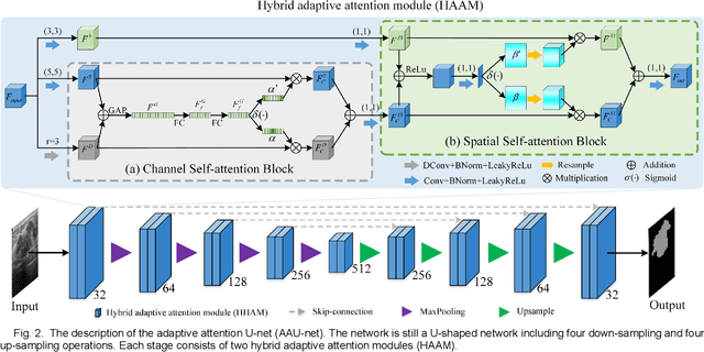 Figure 2 for AAU-net: An Adaptive Attention U-net for Breast Lesions Segmentation in Ultrasound Images