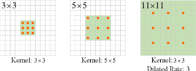 Figure 3 for AAU-net: An Adaptive Attention U-net for Breast Lesions Segmentation in Ultrasound Images