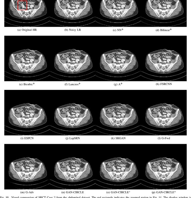 Figure 2 for CT Super-resolution GAN Constrained by the Identical, Residual, and Cycle Learning Ensemble