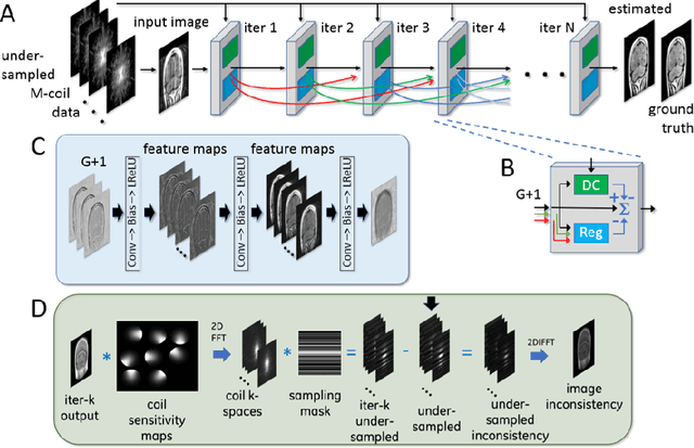 Figure 4 for Adaptive Gradient Balancing for UndersampledMRI Reconstruction and Image-to-Image Translation