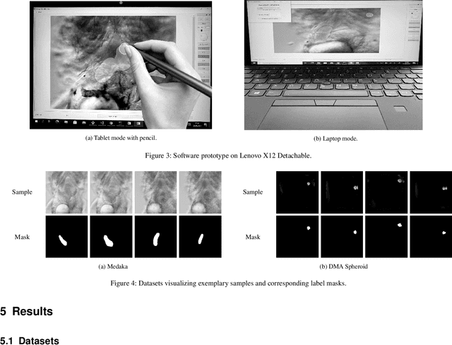 Figure 3 for Label Assistant: A Workflow for Assisted Data Annotation in Image Segmentation Tasks