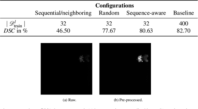 Figure 4 for Label Assistant: A Workflow for Assisted Data Annotation in Image Segmentation Tasks