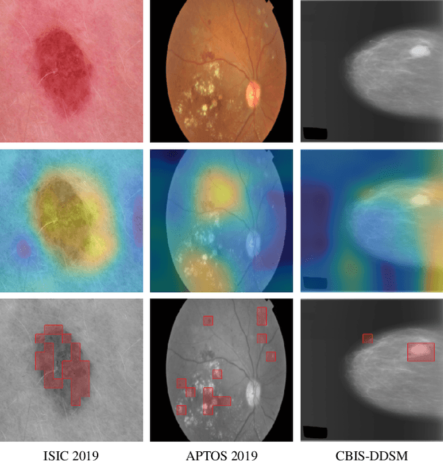 Figure 2 for Is it Time to Replace CNNs with Transformers for Medical Images?