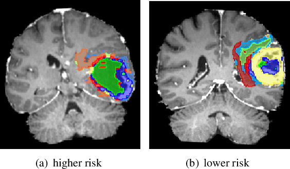Figure 3 for Bayesian optimization assisted unsupervised learning for efficient intra-tumor partitioning in MRI and survival prediction for glioblastoma patients