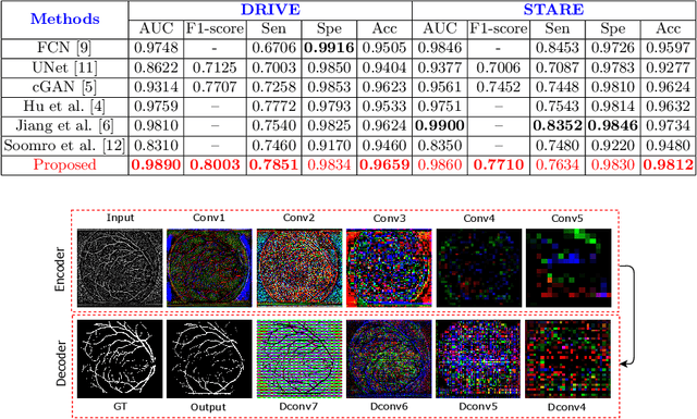 Figure 2 for Adversarial Learning with Multiscale Features and Kernel Factorization for Retinal Blood Vessel Segmentation