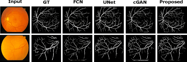 Figure 4 for Adversarial Learning with Multiscale Features and Kernel Factorization for Retinal Blood Vessel Segmentation