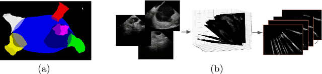 Figure 1 for More Knowledge is Better: Cross-Modality Volume Completion and 3D+2D Segmentation for Intracardiac Echocardiography Contouring