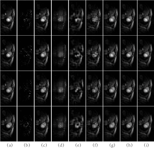 Figure 3 for Effective Tensor Completion via Element-wise Weighted Low-rank Tensor Train with Overlapping Ket Augmentation