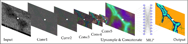 Figure 1 for High throughput quantitative metallography for complex microstructures using deep learning: A case study in ultrahigh carbon steel