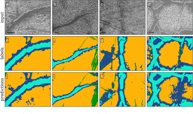 Figure 3 for High throughput quantitative metallography for complex microstructures using deep learning: A case study in ultrahigh carbon steel