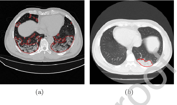 Figure 1 for Deep Co-supervision and Attention Fusion Strategy for Automatic COVID-19 Lung Infection Segmentation on CT Images