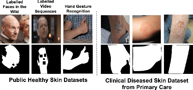 Figure 1 for Segmentation of both Diseased and Healthy Skin from Clinical Photographs in a Primary Care Setting
