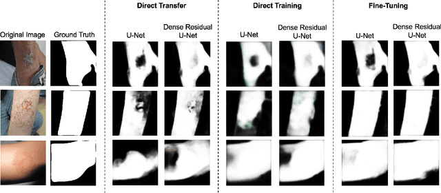 Figure 3 for Segmentation of both Diseased and Healthy Skin from Clinical Photographs in a Primary Care Setting
