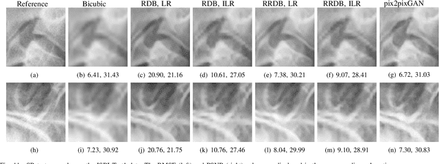 Figure 3 for Cephalogram Synthesis and Landmark Detection in Dental Cone-Beam CT Systems