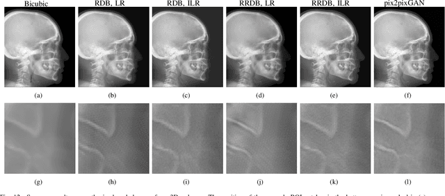 Figure 4 for Cephalogram Synthesis and Landmark Detection in Dental Cone-Beam CT Systems