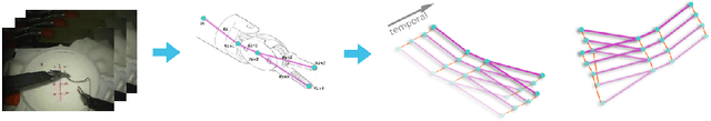 Figure 1 for Towards Generalizable Surgical Activity Recognition Using Spatial Temporal Graph Convolutional Networks