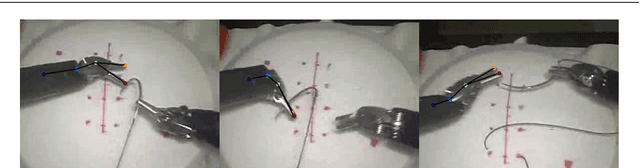 Figure 3 for Towards Generalizable Surgical Activity Recognition Using Spatial Temporal Graph Convolutional Networks