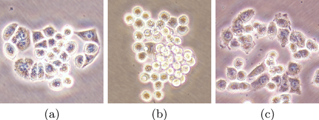 Figure 1 for DeepDistance: A Multi-task Deep Regression Model for Cell Detection in Inverted Microscopy Images