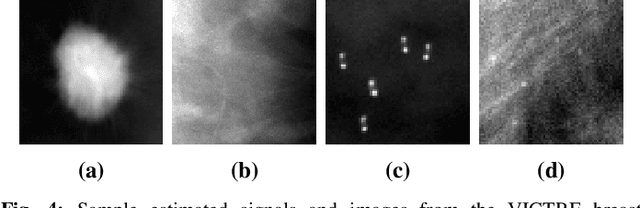Figure 4 for Approximating the Hotelling Observer with Autoencoder-Learned Efficient Channels for Binary Signal Detection Tasks