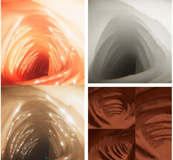 Figure 1 for Automatic Generation of Synthetic Colonoscopy Videos for Domain Randomization