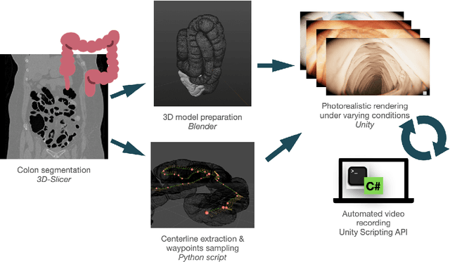 Figure 2 for Automatic Generation of Synthetic Colonoscopy Videos for Domain Randomization