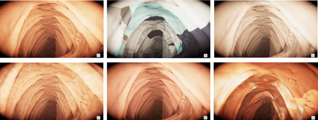 Figure 3 for Automatic Generation of Synthetic Colonoscopy Videos for Domain Randomization