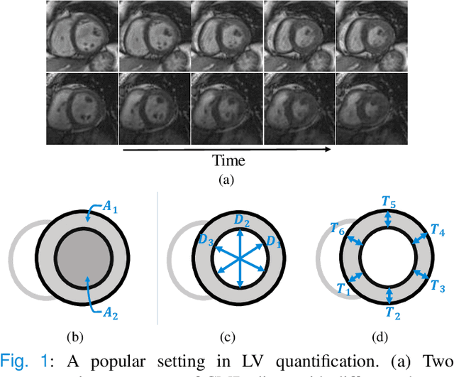 Figure 1 for Steerable Pyramid Transform Enables Robust Left Ventricle Quantification