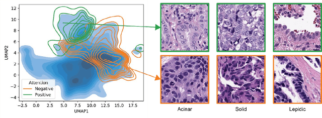 Figure 3 for H&E-based Computational Biomarker Enables Universal EGFR Screening for Lung Adenocarcinoma