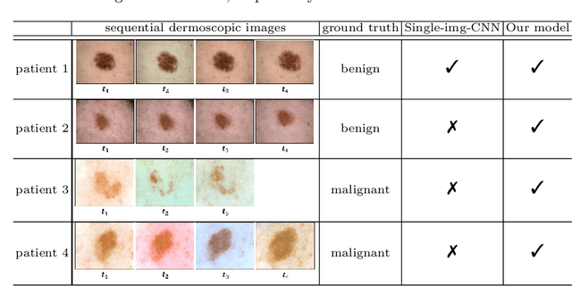 Figure 4 for Melanoma Diagnosis with Spatio-Temporal Feature Learning on Sequential Dermoscopic Images